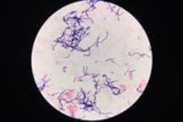 Streptococcus pyogenes